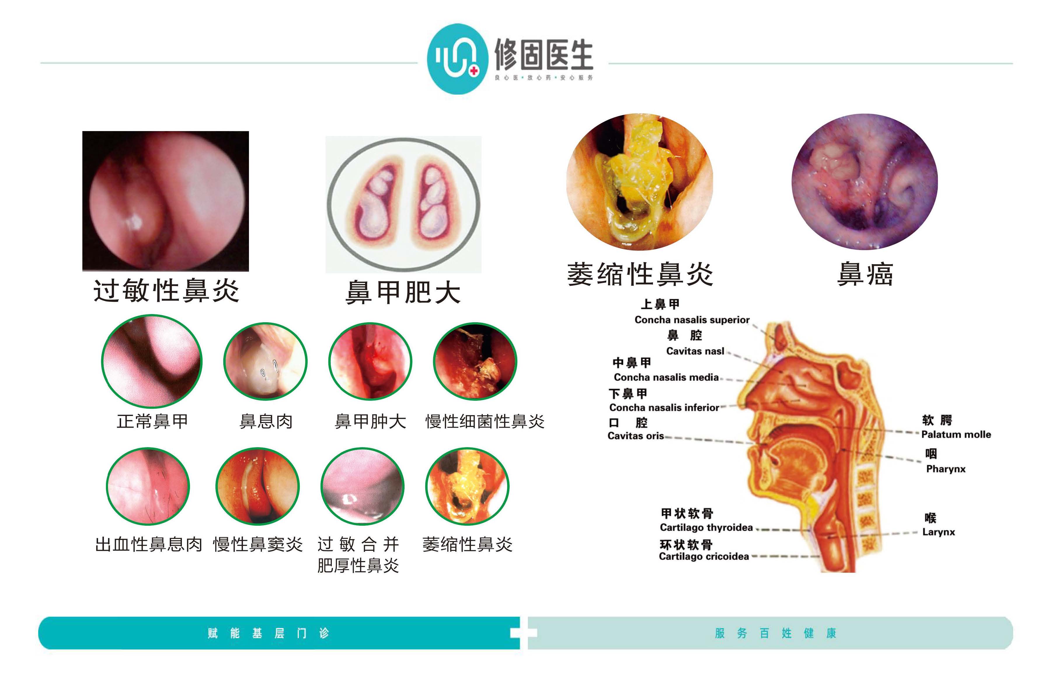 宋超特色鼻炎课件_页面_13.jpg